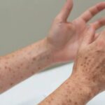 WhatsApp Image 2026-03-04 at 09.08.48